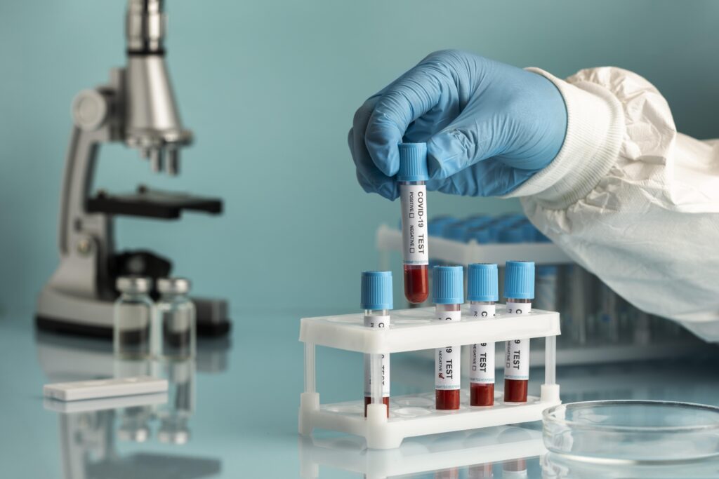 Blood test lab in Sharjah at IRC diagnostic center Blood test in Buhairah 
