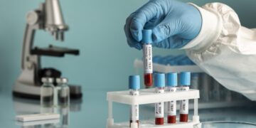 hand-with-protective-gloves-holding-blood-samples-covid-test hand-with-protective-gloves-holding-blood-samples-covid-test